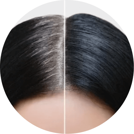 Reverse Premature Greying
