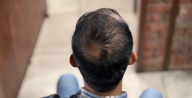 before using supergrow hair serum