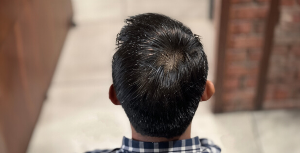 after using supergrow hair serum