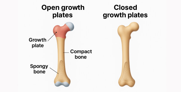Height Increased After Growth Plates Close
