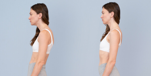 Posture